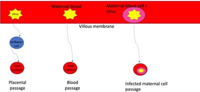 SARS-CoV-2 vertical transmission supports innate fetal protection: A narrative review